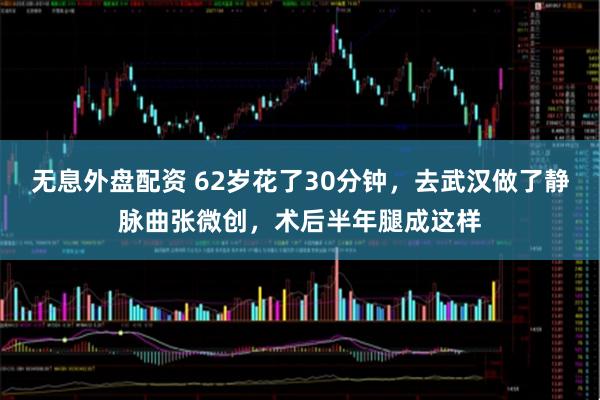 无息外盘配资 62岁花了30分钟，去武汉做了静脉曲张微创，术后半年腿成这样